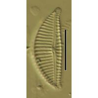Encyonema lange-bertalotiii