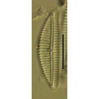 Encyonema silesiacum