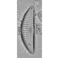 Encyonema silesiacum