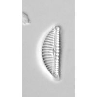 Encyonema silesiacum