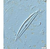Encyonema lunatum