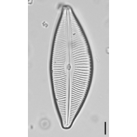 Encyonema minutum