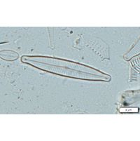 Encyonopsis falaisensis