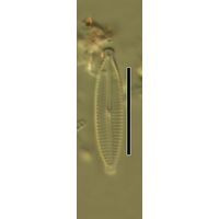 Encyonopsis microcephala