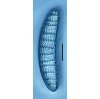 Epithemia adnata