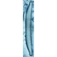 Epithemia adnata