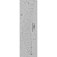 Epithemia adnata