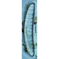 Epithemia adnata