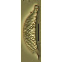 Epithemia sorex