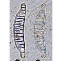Epithemia adnata