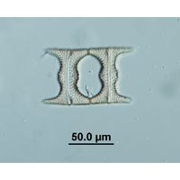 Eucampia balaustinum