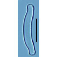 Eunotia exigua