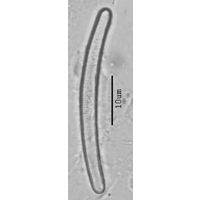 Eunotia bilunaris
