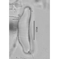Eunotia diodon