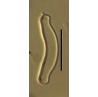 Eunotia exigua