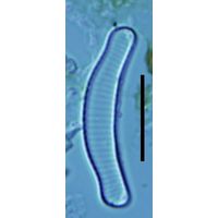 Eunotia exigua