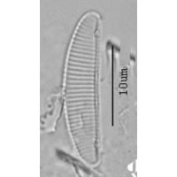 Eunotia incisa