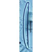 Eunotia incisa