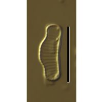 Eunotia praerupta