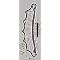 Eunotia hexaglyphis