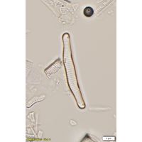 Eunotia implicata