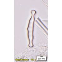 Eunotia microcephala