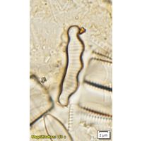 Eunotia paratridentula