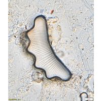 Eunotia tetraodon