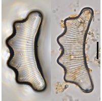 Eunotia tetraodon