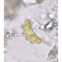 Eunotia tetraodon
