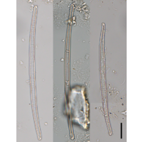Eunotia juettnerae