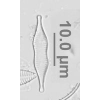 Pseudostaurosira parasitica