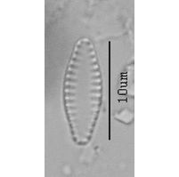 Fragilaria brevistriata