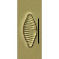 Fragilaria capucina