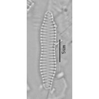 Fragilaria construens