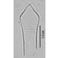 Fragilaria dilatata