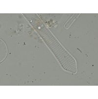 Fragilaria dilatata