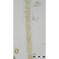 Fragillaria