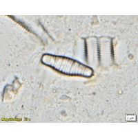 Fragilariforma bicapitata