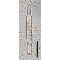 Fragilariforma bicapitata