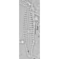 Gompohcymbellopsis ancyli