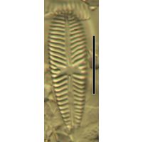 Gomphoneis olivacea
