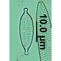 Gomphonema parvulum