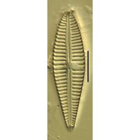 Gomphonema affine