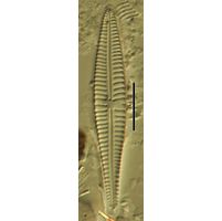 Gomphonema angustatum