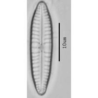 Gompohonema angustatum