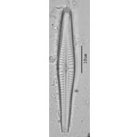 Gompohonema angustum