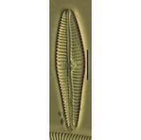 Gomphonema