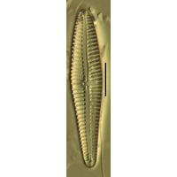 Gomphonema