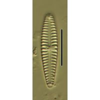 Gomphonema clavatulum